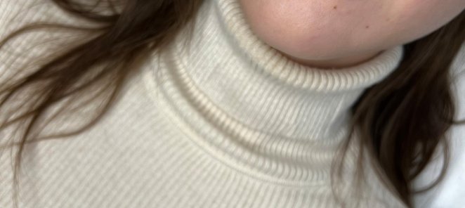 Скидка на увеличение губ Belotero Lips