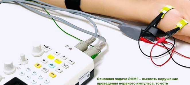 Электронейромиография