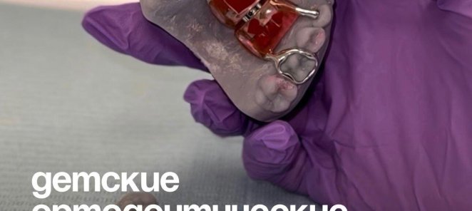 Скидка 10% на детские ортодонтические аппараты и пластинки