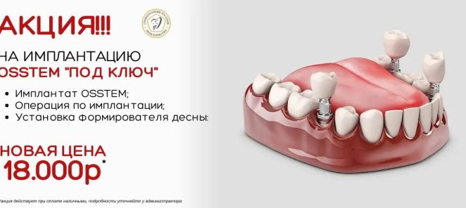 Акция! Имплантация OSSTEM 