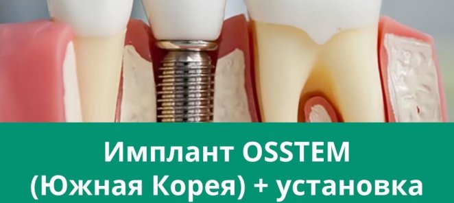OSSTEM IMPLANT (Южная Корея) + установка