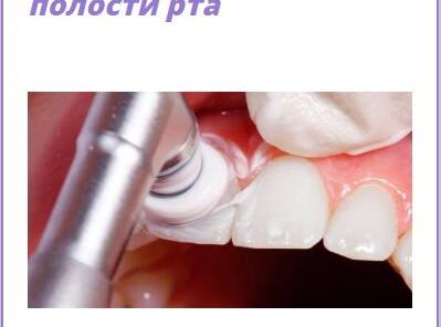 Комплексная гигиена полости рта - 7500 р