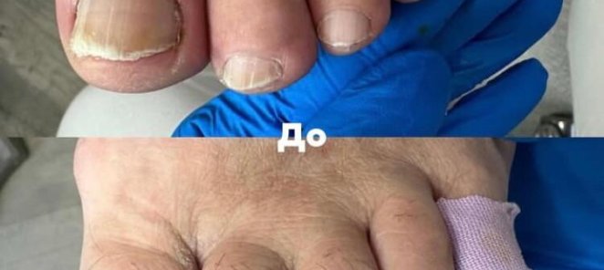 О консультации на первом визите