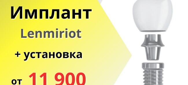 Установка зубного импланта от 11 900 руб