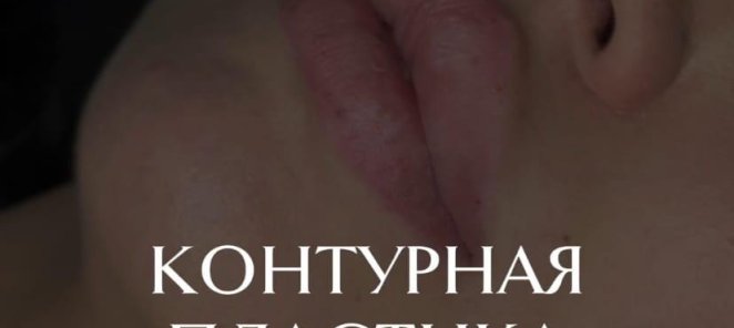 Контурная пластика