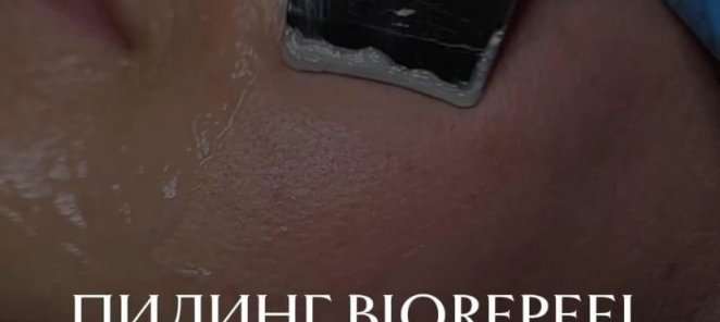 Комбинированная чистка лица