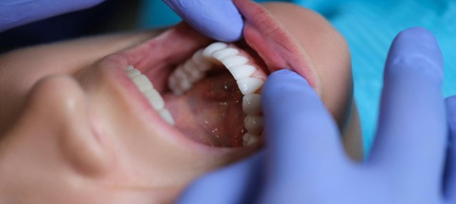 Имплант первичным пациентам в подарок!🦷