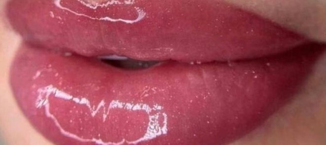 ЗАПИШИСЬ НА БЕСПЛАТНУЮ КОНСУЛЬТАЦИЮ