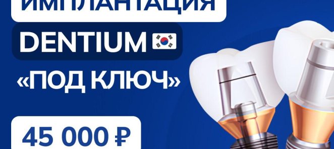Имплантация зубов — 45 000 ₽