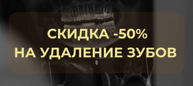 Скидка 50% на удаление зубов при имплантации