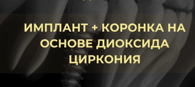 Имплантация под ключ