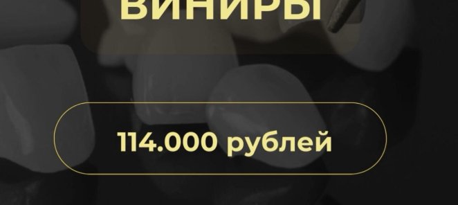 Виниры 114.000 за 6 едениц