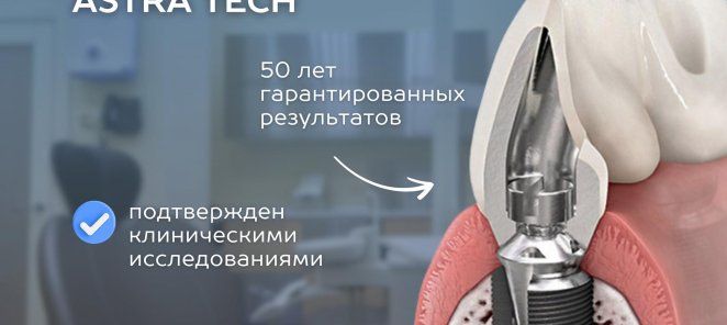 НА ИМПЛАНТЫ ASTRA TECH СКИДКА -20%