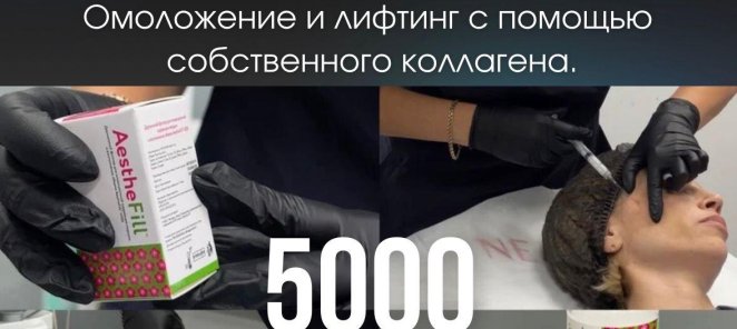 ПОЛИМОЛОЧНАЯ КИСЛОТА - AESTHEFILL 5000р. СКИДКА