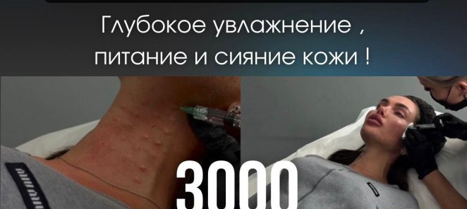 БИОРЕПАРАЦИЯ ПРЕПАРАТОМ PLINEST (ЛИЦО ШЕЯ) 3000р. СКИДКА