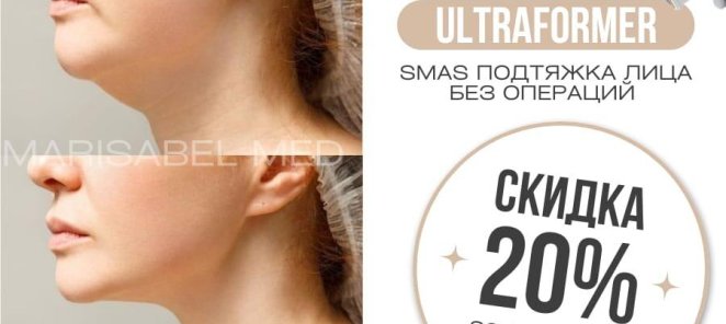 ULTRAFORMER SMAS ПОДТЯЖКА ЛИЦА БЕЗ ОПЕРАЦИЙ