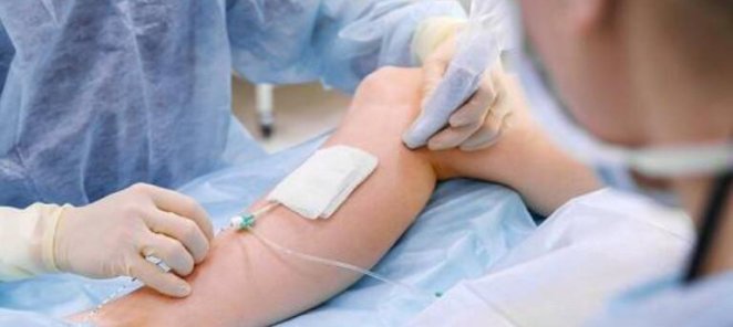 50% скидка на прием флеболога + УЗИ поверхностных вен ног