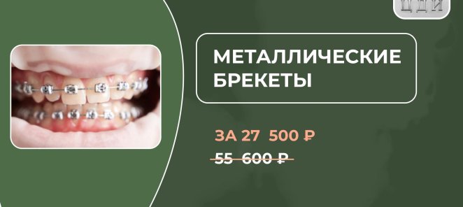 Металлические брекеты на 1 челюсть за 27 500 Р