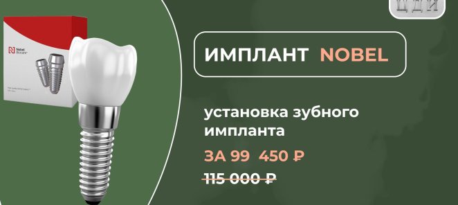 Имплант 