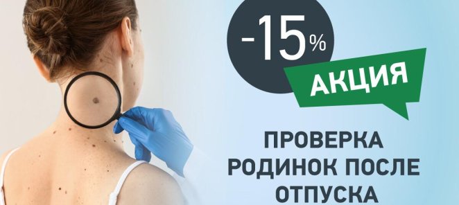 Проверка родинок после отпуска