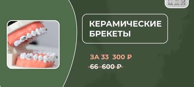 Керамическая брекет-система на 1 челюсть за 33 300 Р