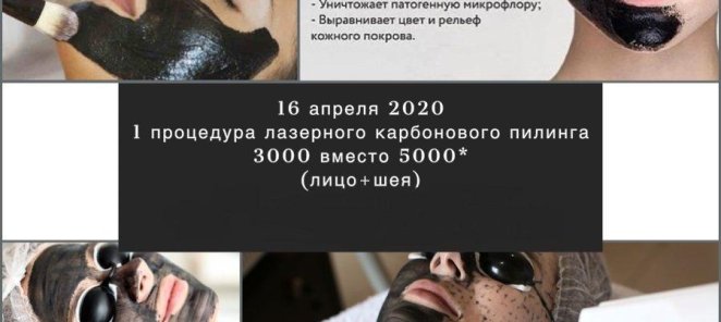 1 процедура карбонового пилинга - 5000 рублей (лицо).