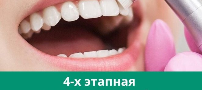 Профессиональная чистка зубов - 3000 руб.