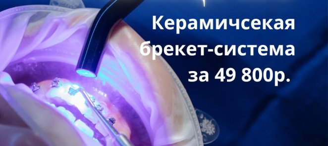 Брекет-система (керамическая) 49 800 ₽