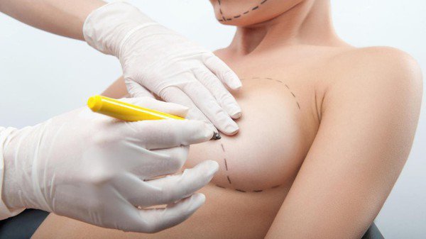 Удаление и замена имплантов груди