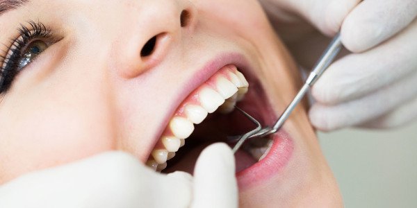 Внутриканальное отбеливание зубов
