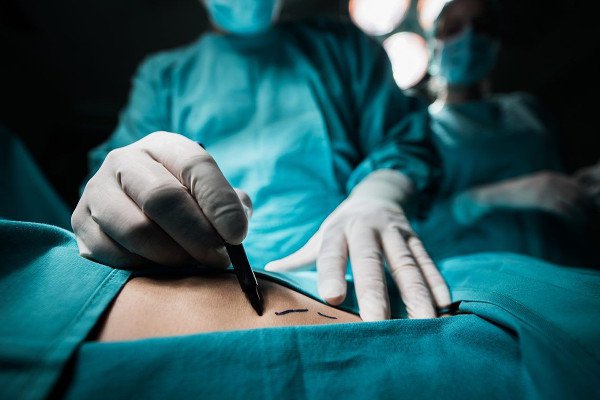70% клиник пластической хирургии нарушали законодательство РФ