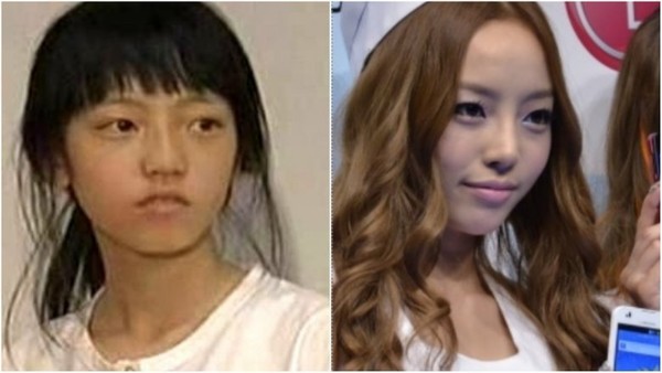 K-поп-звезды до и после пластической операции