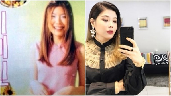 K-поп-звезды до и после пластической операции