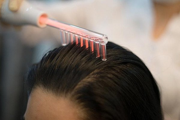 Током по голове: как дарсонваль улучшает структуру и укрепляет здоровье волос