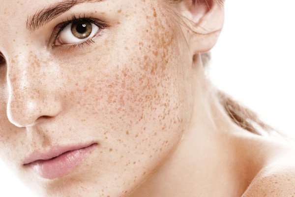Какие проблемы кожи можно предупредить, и как это сделать?