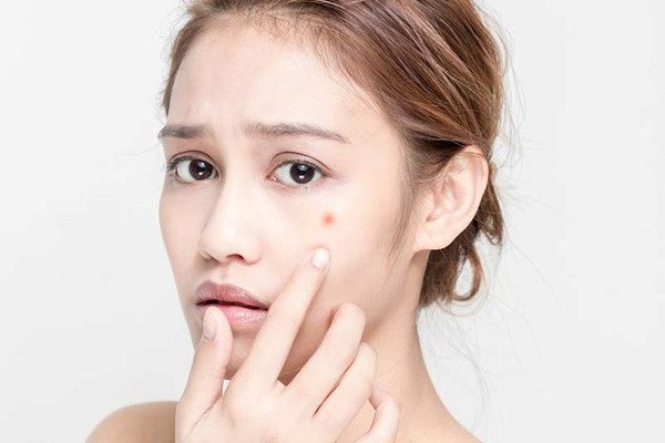 Уход за кожей с акне: какие процедуры помогут, а какие крайне нежелательны