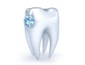 Crystal Dent